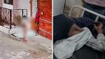 उज्जैन रेप कांड के आरोपी ने की भागने की कोशिश, पुलिस के एनकाउंटर में हुआ घायल
